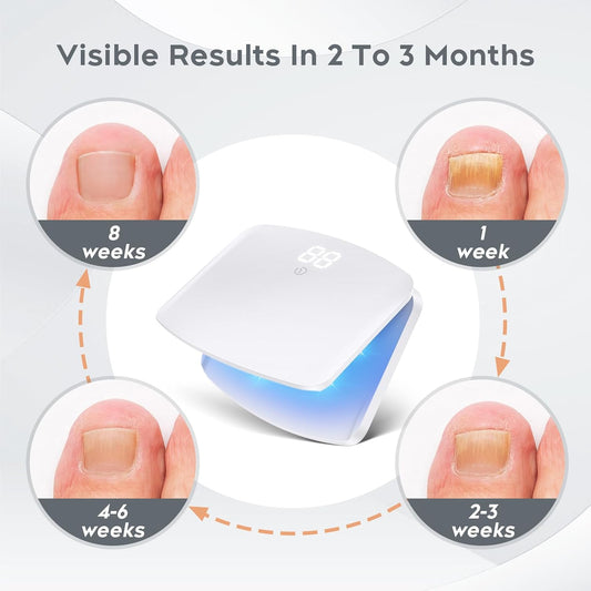 Good Price Nail Cleaning Light Device for Natural Nail Repair & Toenail Treatment, Professional Nail Care for Damaged and Discolored Nails - Home & Travel Use
